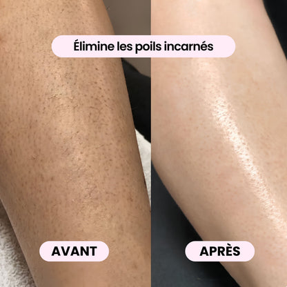 Rasoir 2-en-1 corps & bikini - BODYKLYNE